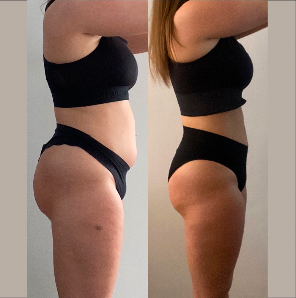 Transformation avant et après de Laura, qui a perdu 10 kg